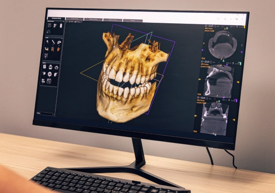 Advanced 3D Imaging for Precise Dental Care