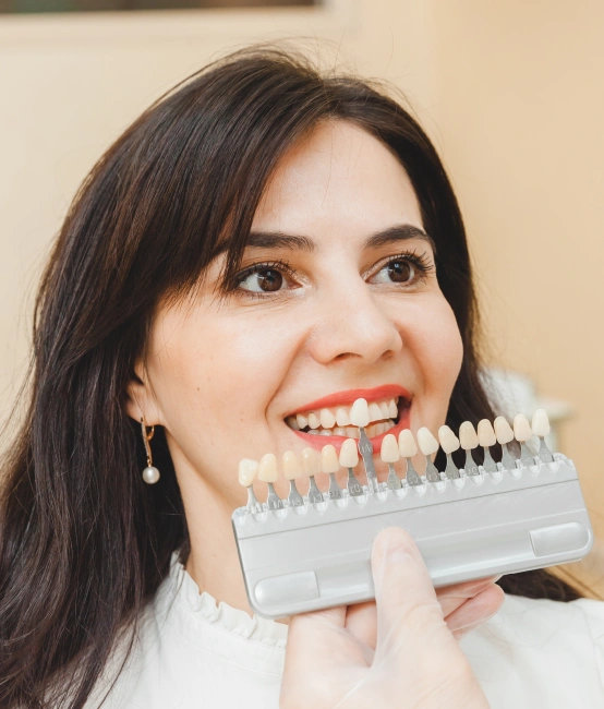 Dental veneers bonded to front teeth for a natural smile makeover.