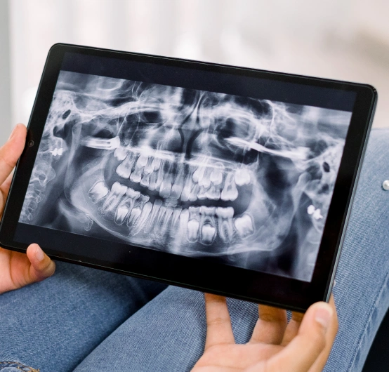 Digital X-Rays for Faster, Clearer Diagnostics