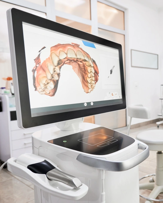 Modern Digital Dental Impression Technology