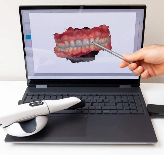 Advanced Intraoral Cameras for Precise Care